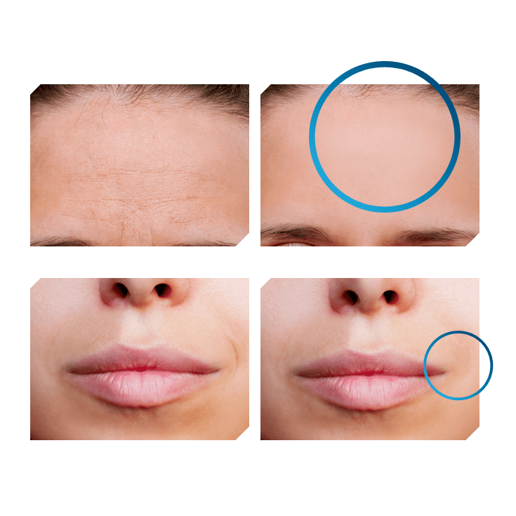 Oxylab Efekty Zabiegowe