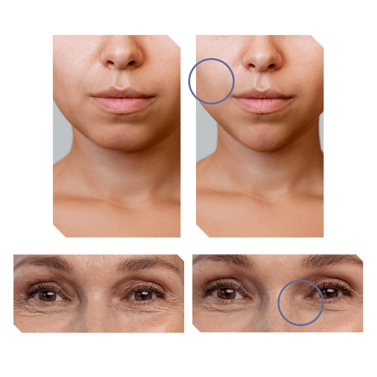 Mesolab Efekty Zabiegowe